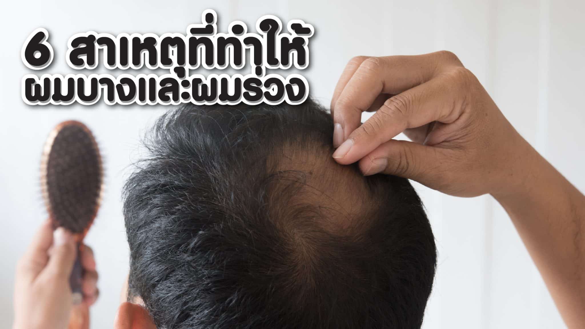 สาเหตุผมร่วง