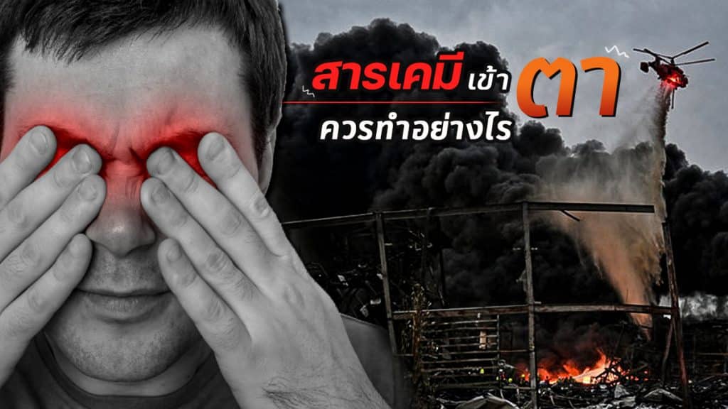 สารเคมีเข้าตาควรทําอย่างไร