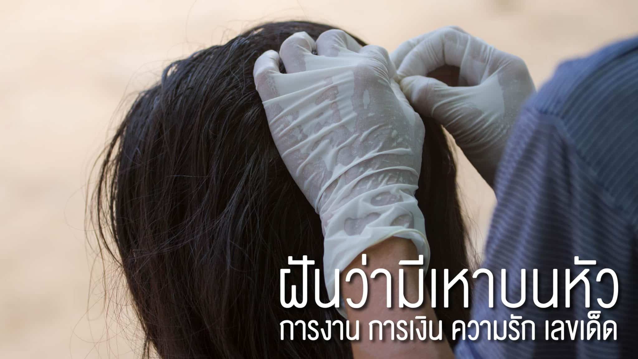 ฝันว่ามีเหาบนหัว