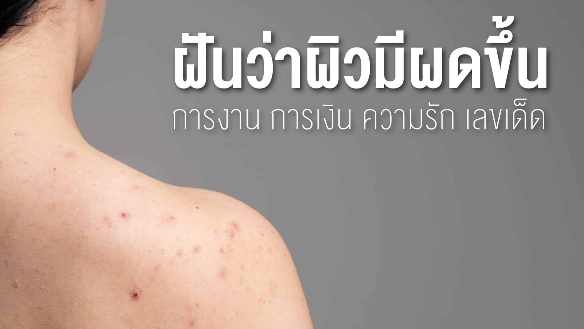 ฝันว่าผิวมีผดขึ้น