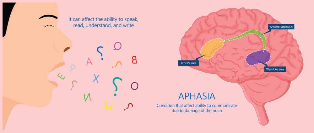 Aphasia คืออะไร